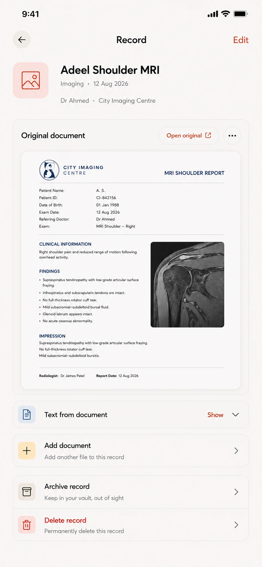 Health Vault record detail showing an original shoulder MRI report and record actions